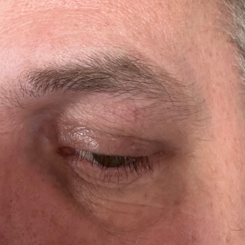 bimsiii